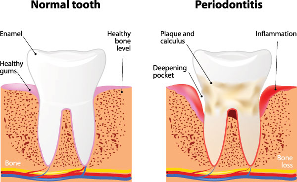 James G. Agnew, DMD | Periodontal Treatment, Dentures and Dental Fillings