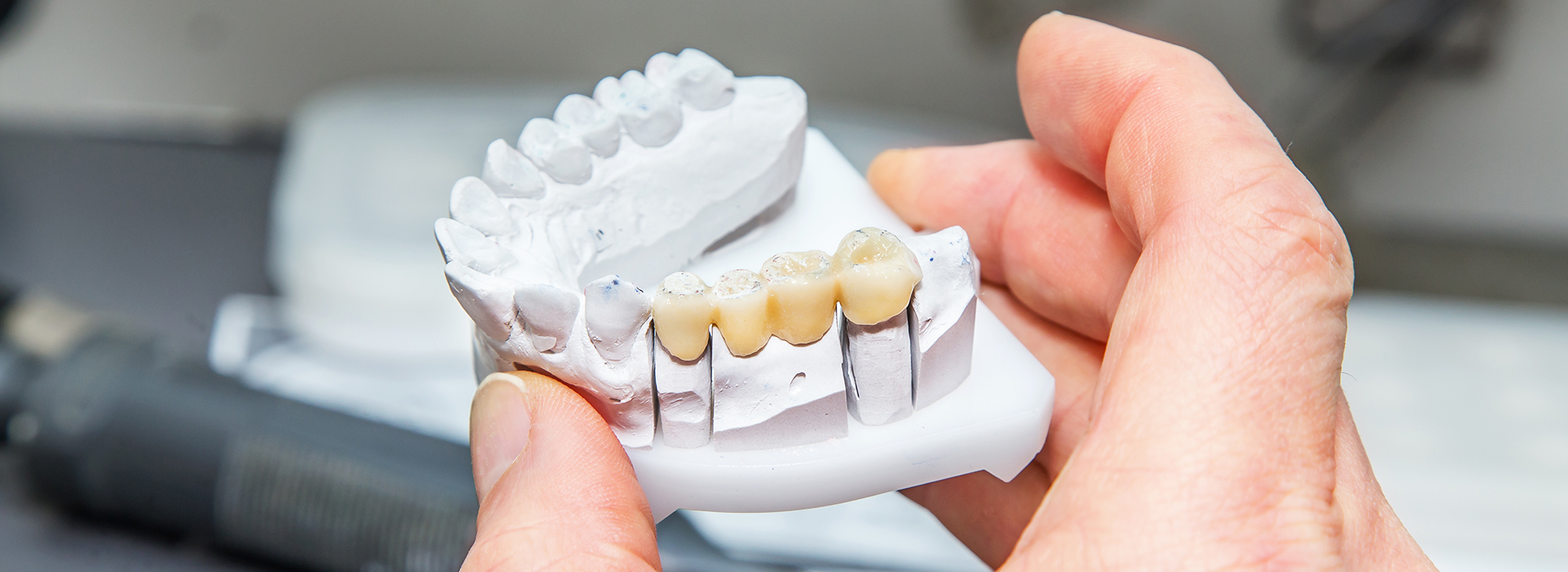 James G. Agnew, DMD | Root Canals, Oral Exams and Veneers
