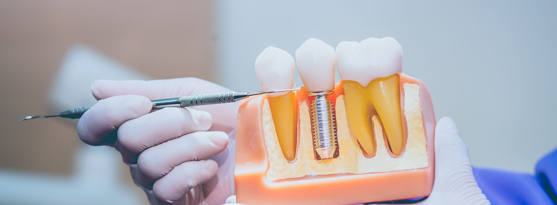 James G. Agnew, DMD | Dental Cleanings, Night Guards and Root Canals