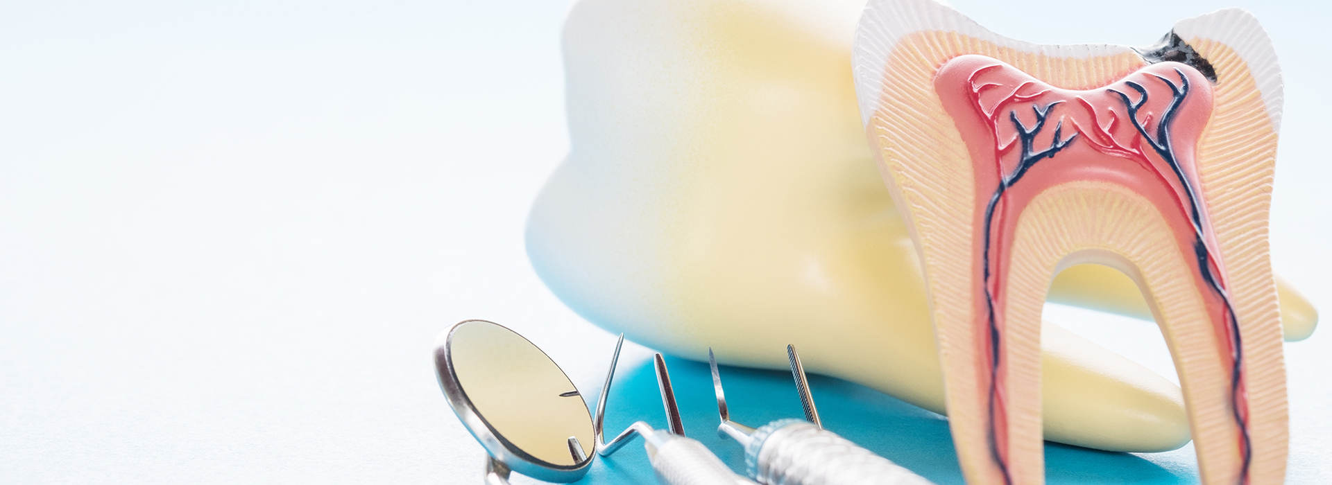 James G. Agnew, DMD | Dental Sealants, Ceramic Crowns and Root Canals