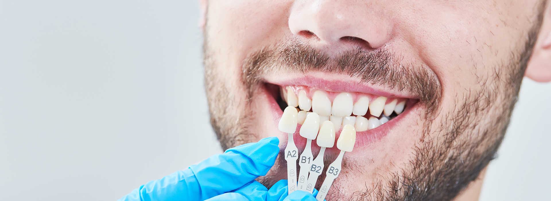 James G. Agnew, DMD | Root Canals, Preventative Program and Fluoride Treatment