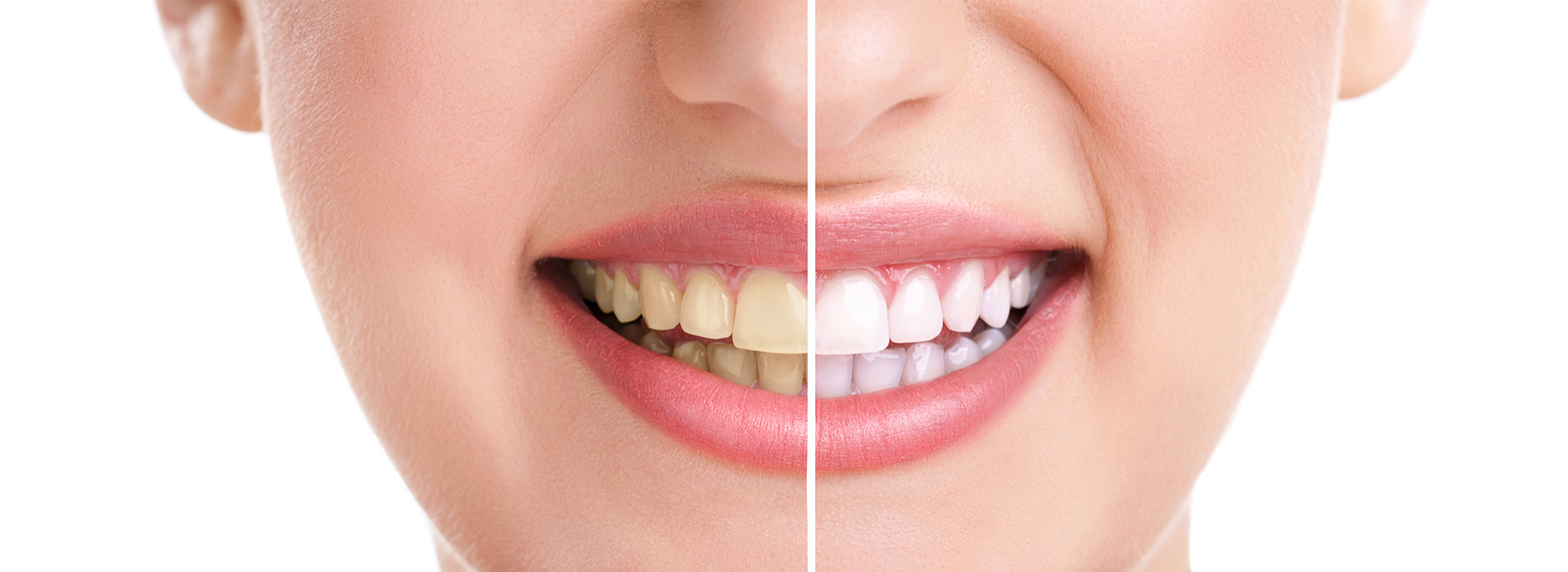 James G. Agnew, DMD | Crowns, Cosmetic Dentistry and Oral Cancer Screening