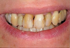 James G. Agnew, DMD | TMJ Disorders, Sports Mouthguards and Implant Restorations