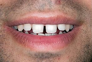 James G. Agnew, DMD | Dental Bridges, Sports Mouthguards and Oral Cancer Screening